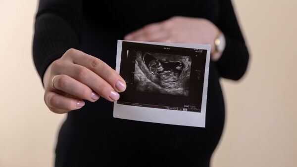Antall aborter i Norge fortsetter å stige