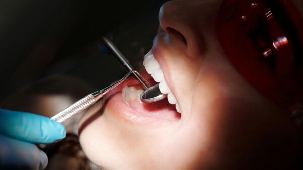 Unge voksne får billigere tannlegetjenester